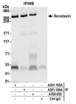 Detection of human Senataxin by western blot of immunoprecipitates.