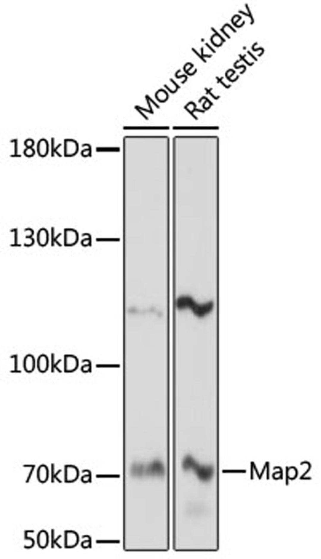 Western blot - Map2 antibody (A17409)