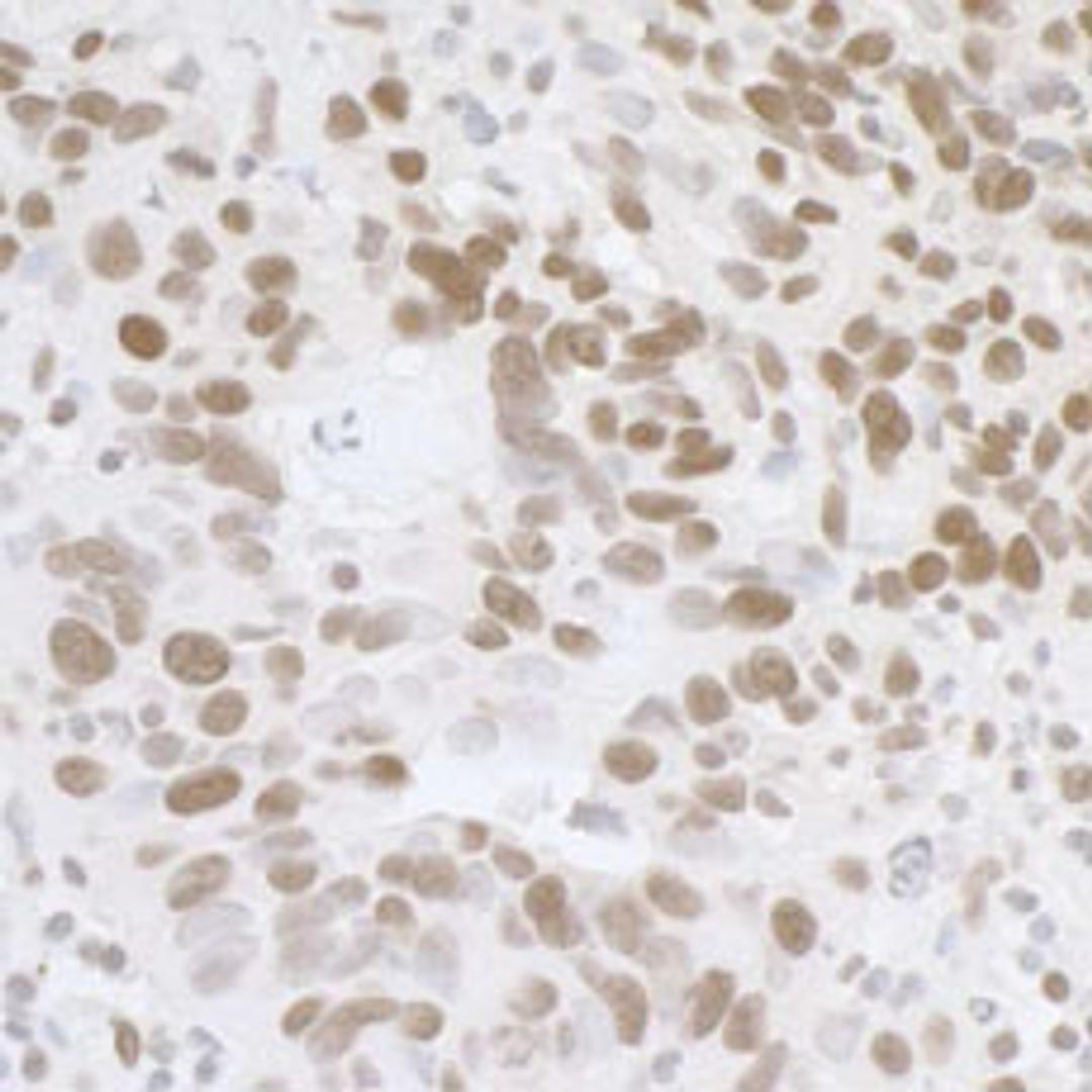 Detection of human FUS by immunohistochemistry.