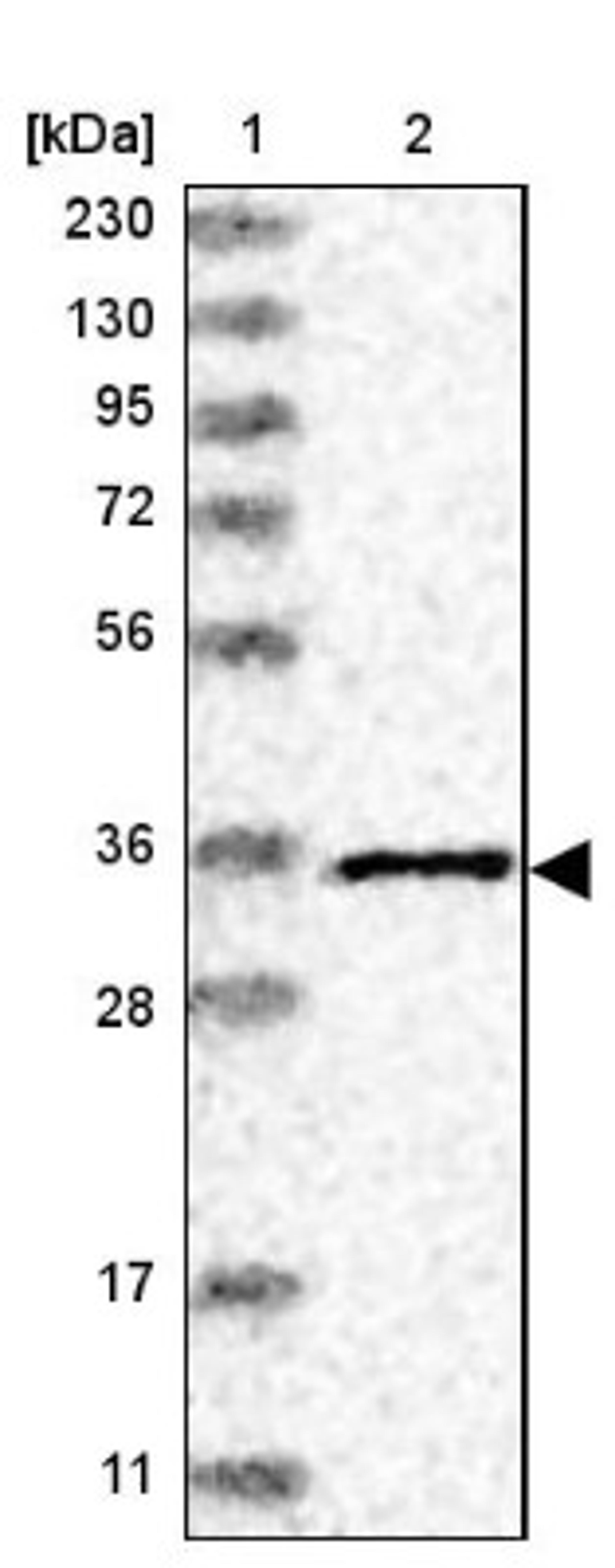 Western Blot: N acetylglucosamine kinase Antibody [NBP1-89750] - Lane 1: Marker [kDa] 230, 130, 95, 72, 56, 36, 28, 17, 11<br/>Lane 2: Human cell line RT-4