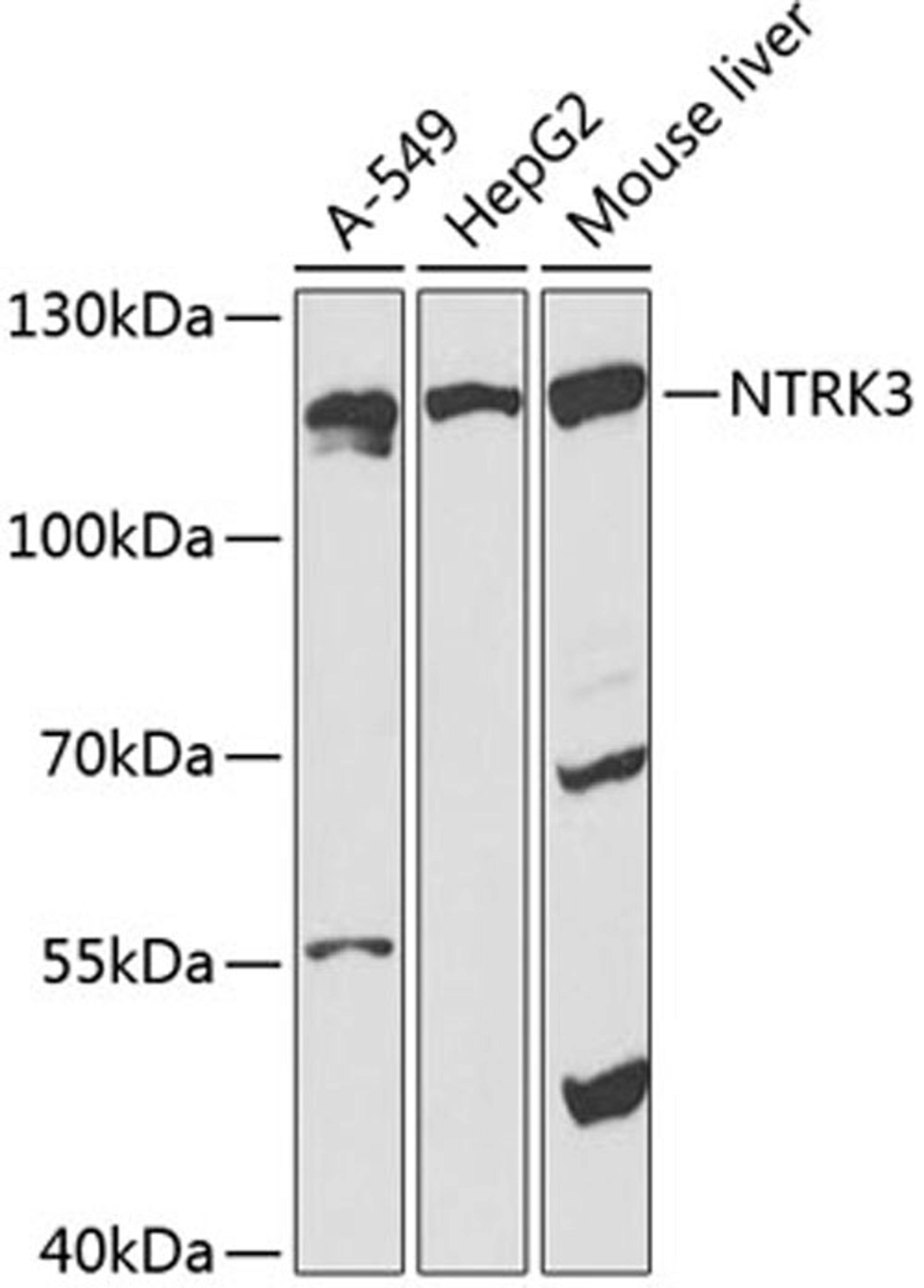 Western blot - NTRK3 antibody (A14033)