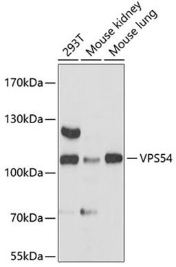 Western blot - VPS54 antibody (A13215)