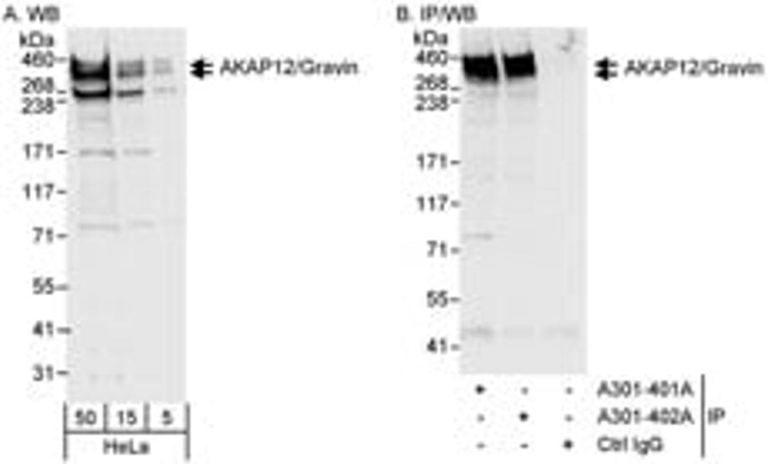 Detection of human AKAP12/Gravin by western blot and immunoprecipitation.