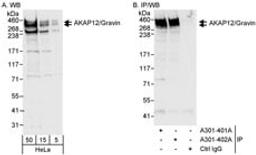 Detection of human AKAP12/Gravin by western blot and immunoprecipitation.