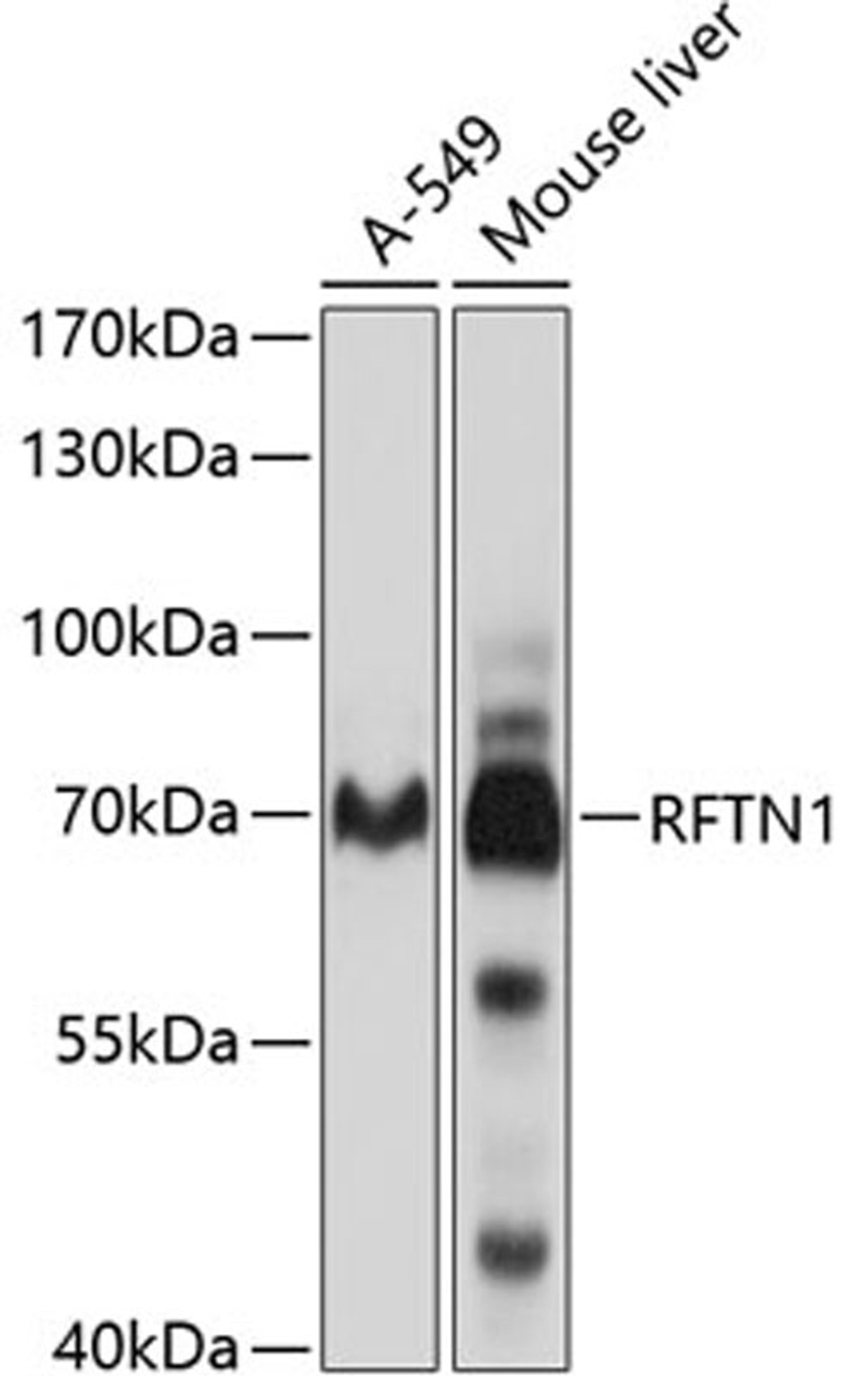 Western blot - RFTN1 antibody (A10430)