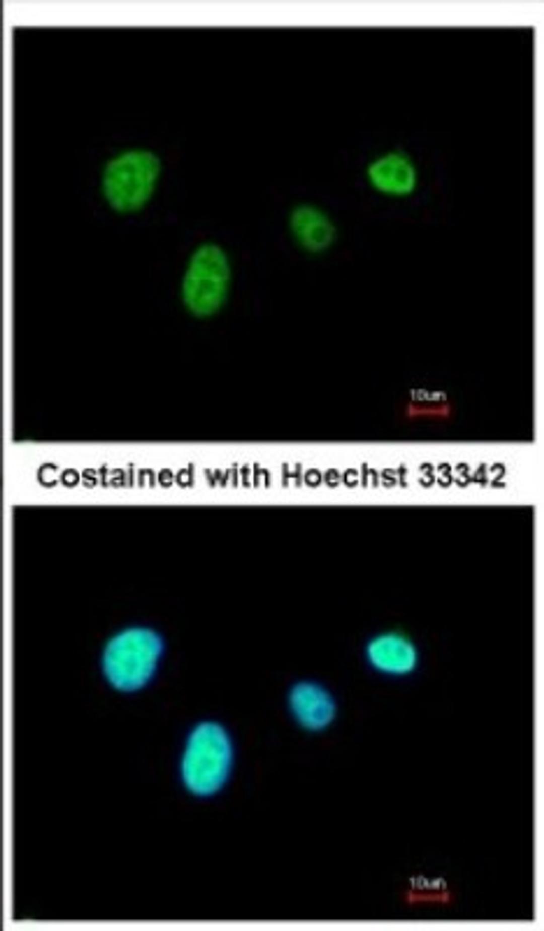 Immunocytochemistry/Immunofluorescence: RFX6 Antibody [NBP2-20143] - Immunofluorescence analysis of paraformaldehyde-fixed A549, using antibody at 1:500 dilution.