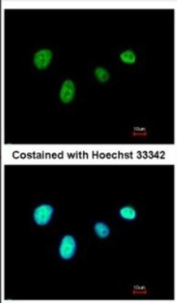 Immunocytochemistry/Immunofluorescence: RFX6 Antibody [NBP2-20143] - Immunofluorescence analysis of paraformaldehyde-fixed A549, using antibody at 1:500 dilution.