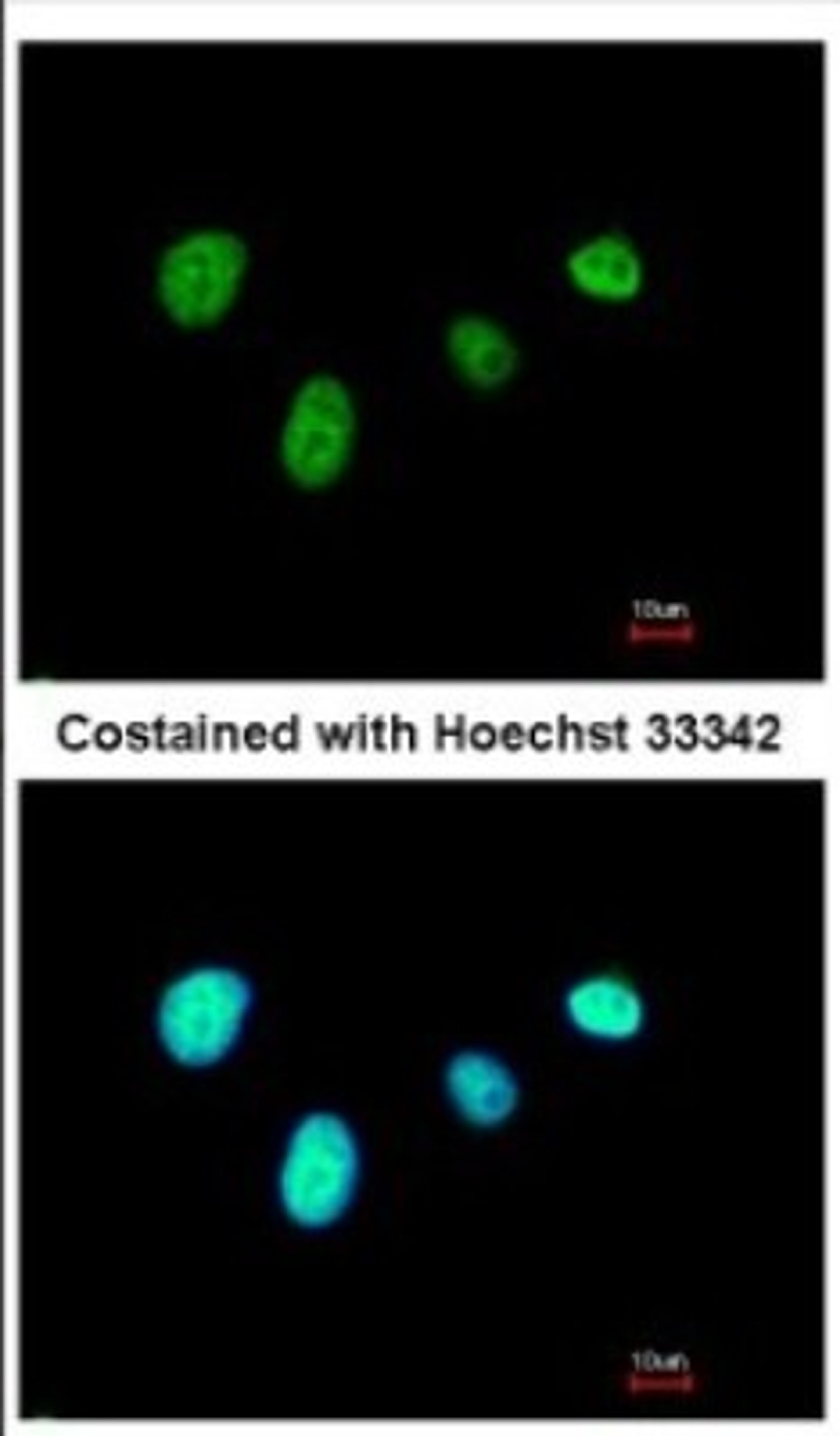 Immunocytochemistry/Immunofluorescence: RFX6 Antibody [NBP2-20143] - Immunofluorescence analysis of paraformaldehyde-fixed A549, using antibody at 1:500 dilution.