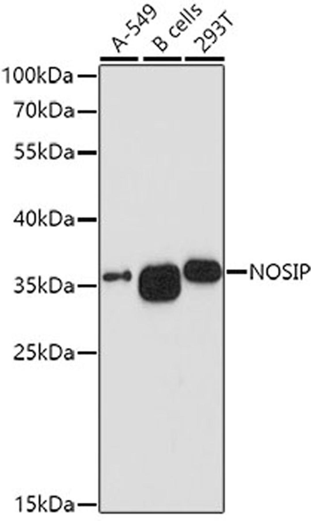 Western blot - NOSIP antibody (A10024)