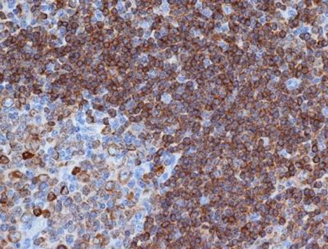 Immunohistochemistry-Paraffin: CD79A Antibody (HM57) [NB100-64347] - Embedded human tonsil.