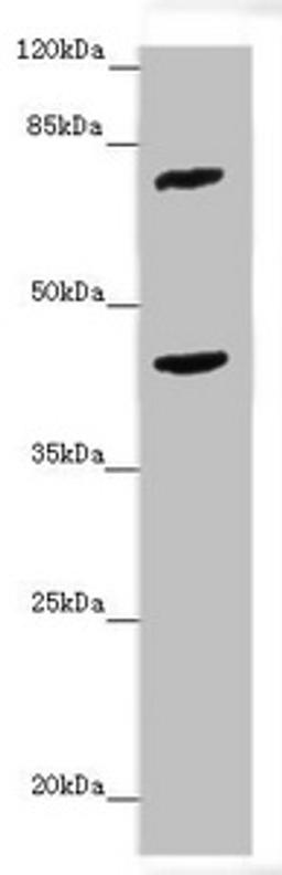 Western blot. All lanes: ACSL6 antibody at 4.25 ug/ml + Mouse liver tissue. Secondary. Goat polyclonal to rabbit IgG at 1/10000 dilution. Predicted band size: 78, 81, 75, 77, 80, 70 kDa. Observed band size: 78, 42 kDa. 
