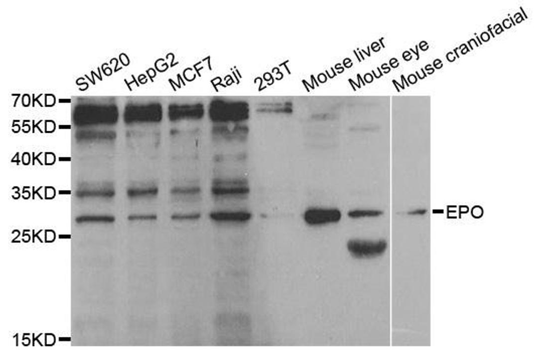 Western blot analysis of extracts of various cell lines using EPO antibody