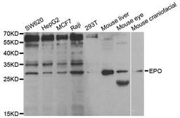 Western blot analysis of extracts of various cell lines using EPO antibody