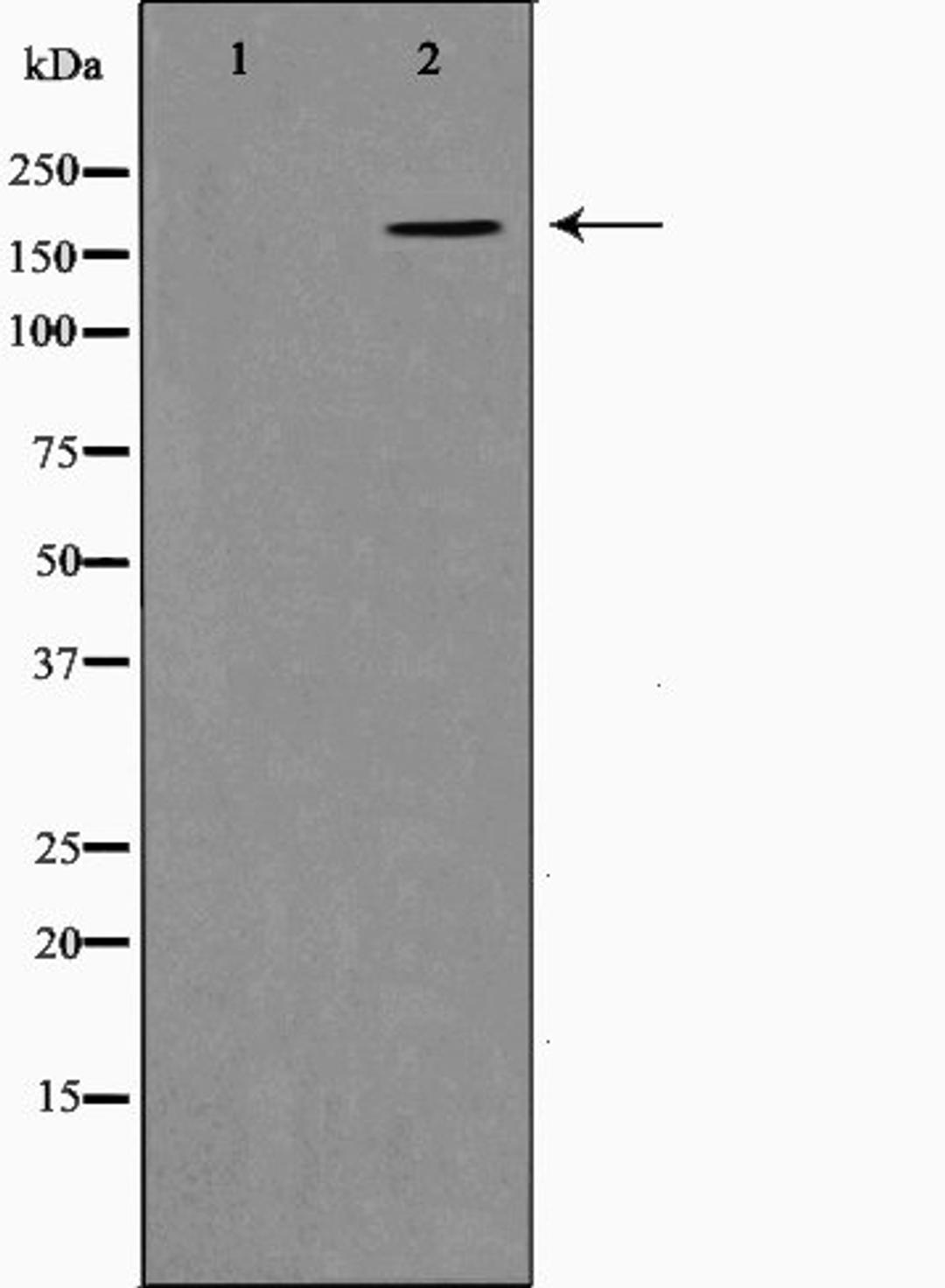 Western blot analysis of K562 cell lysate using Collagen XIalpha 1 antibody