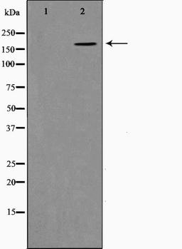 Western blot analysis of K562 cell lysate using Collagen XIalpha 1 antibody