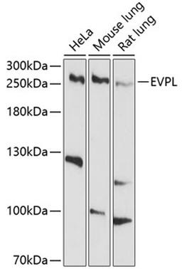 Western blot - EVPL antibody (A10215)