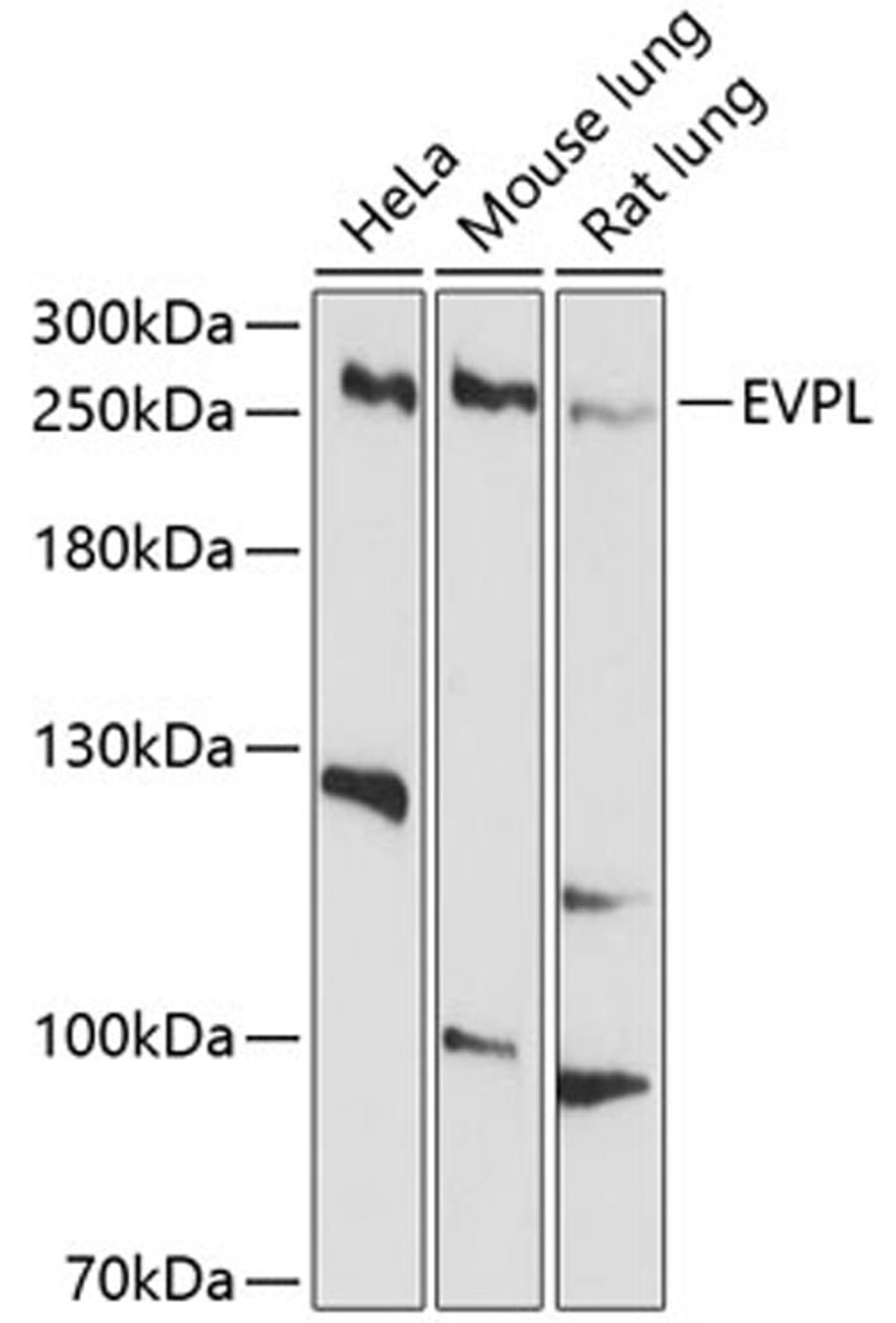 Western blot - EVPL antibody (A10215)