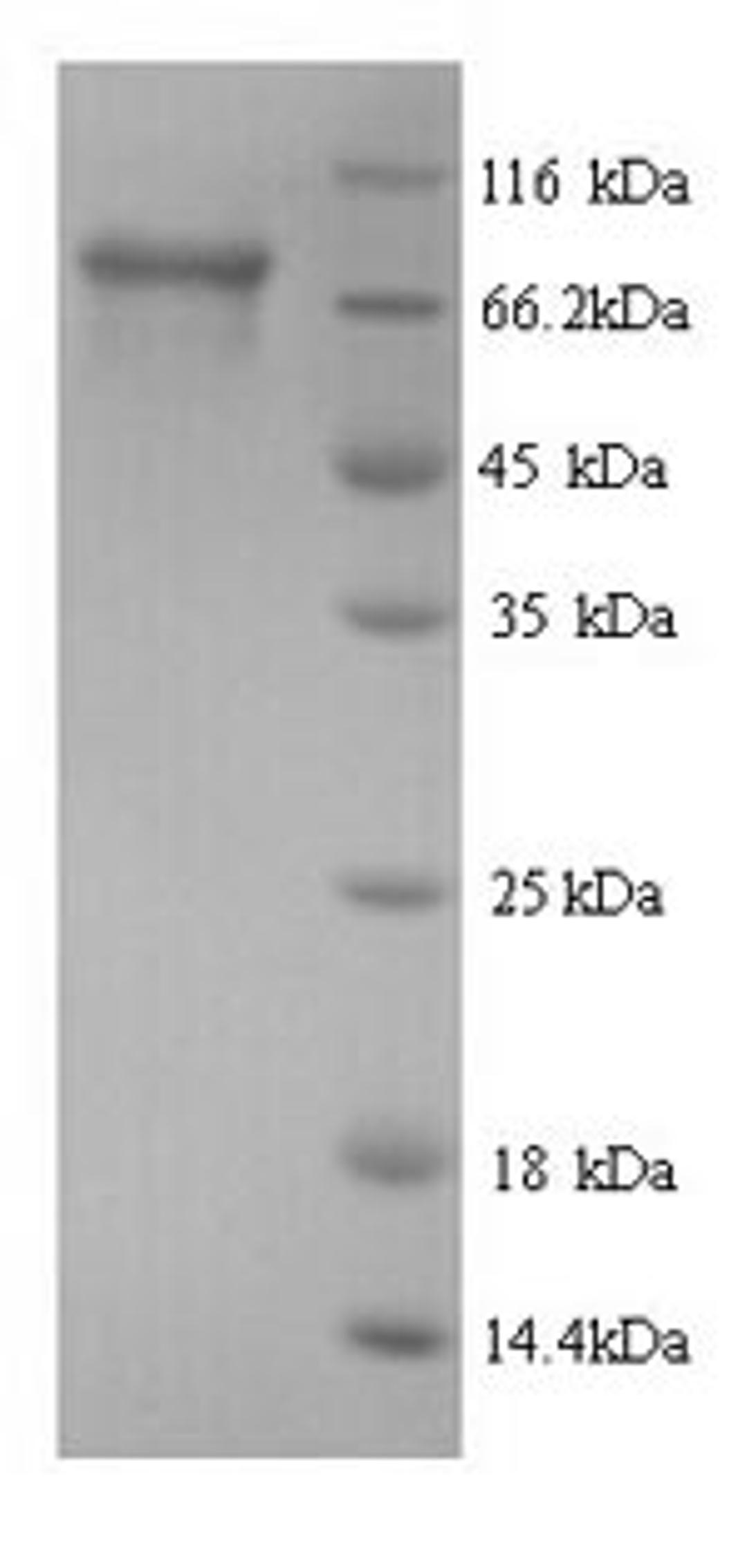 (Tris-Glycine gel) Discontinuous SDS-PAGE (reduced) with 5% enrichment gel and 15% separation gel.