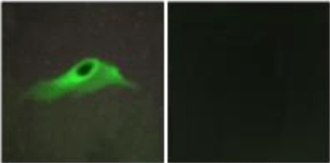 Immunofluorescence analysis of HeLa cell using collagen IV alpha 5 antibody