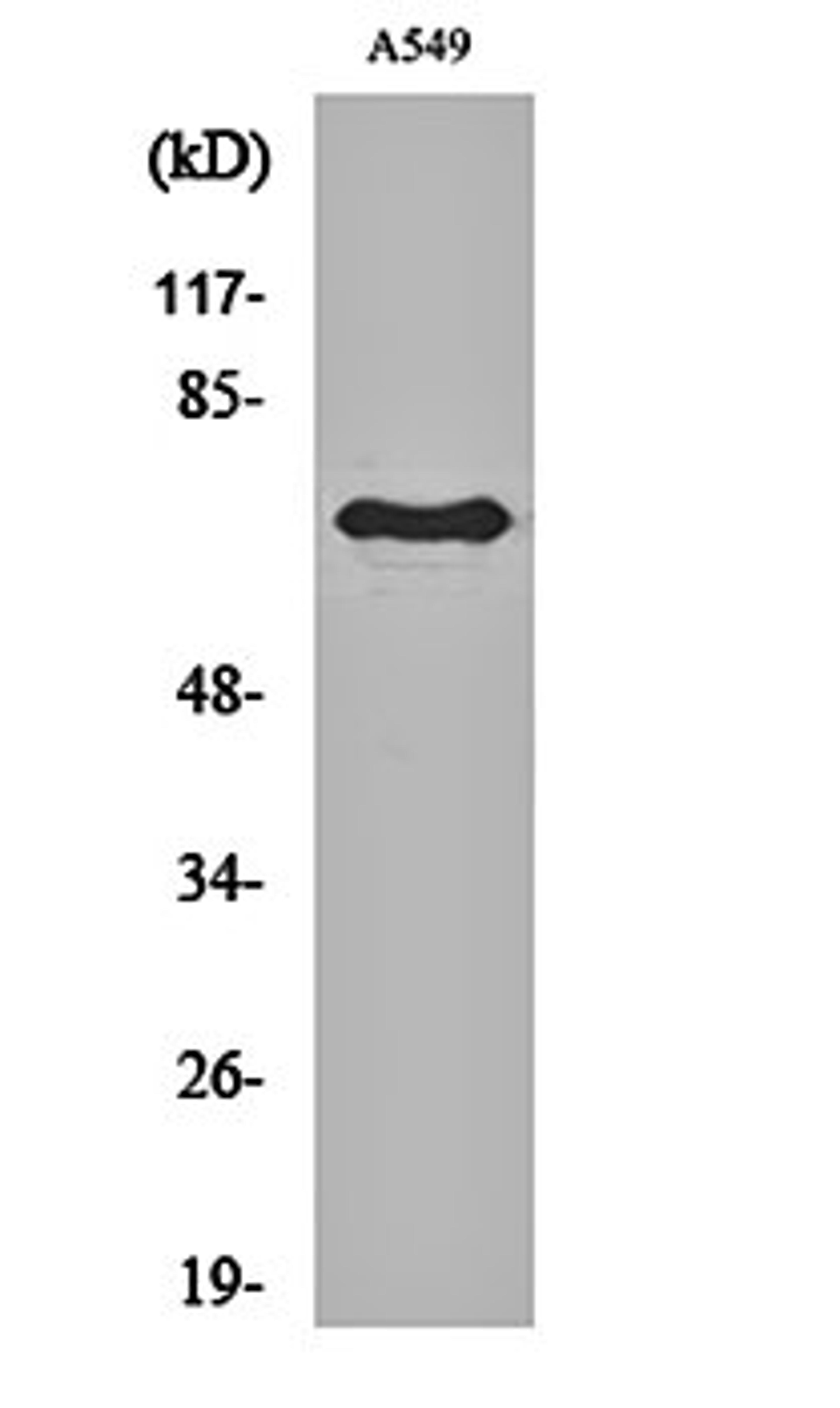 Western blot analysis of A549 cell lysates using Frizzled-3 antibody