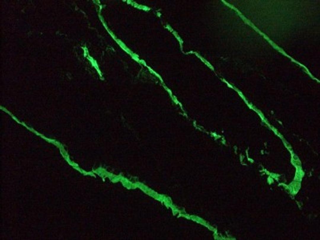 Immunocytochemistry/Immunofluorescence: Cytokeratin 18 Antibody (RGE53) [NBP1-97715] - Staining of a 2 days old zebrafish embryo. Left panel: DAPI-staining of cell nuclei, providing an overview of the tissue section used for immunostaining