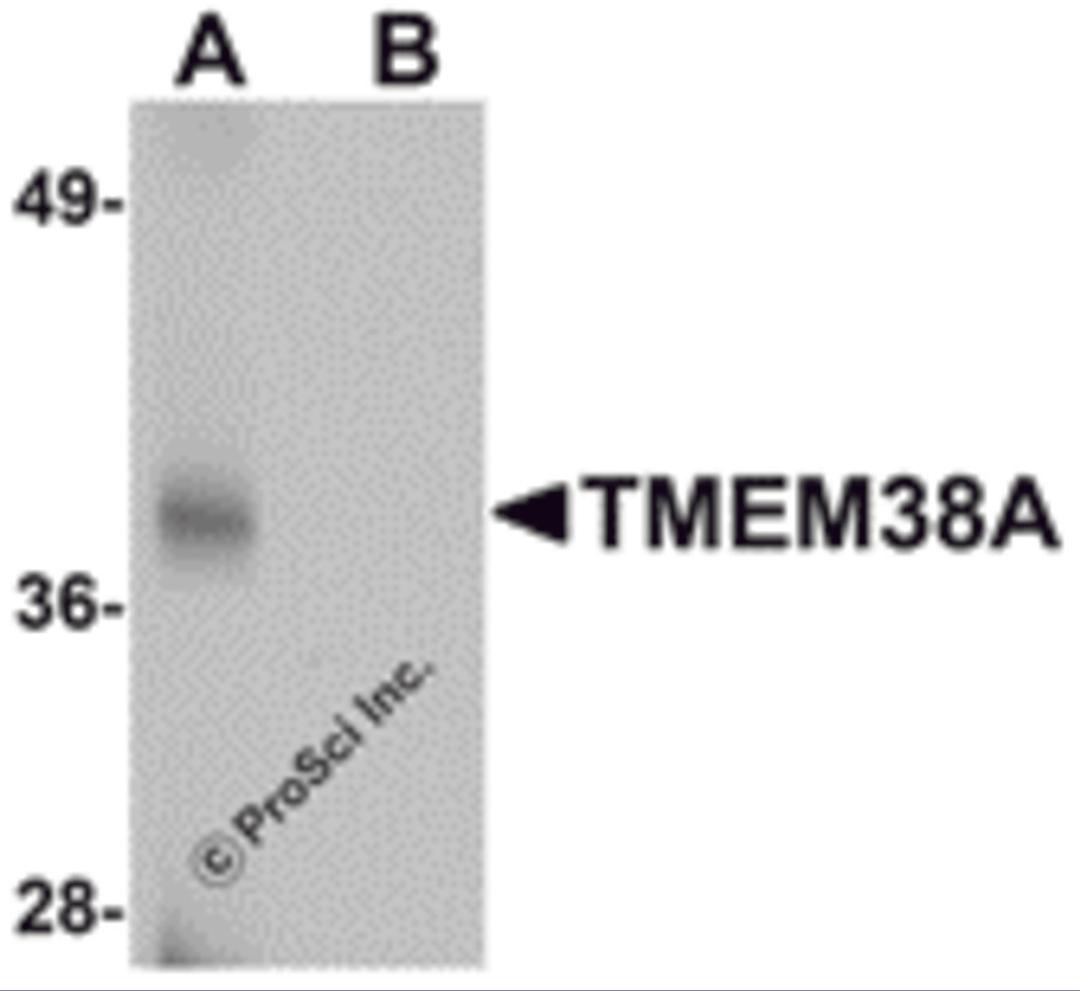 Western blot analysis of TMEM38A in rat skeletal muscle tissue lysate with TMEM38A antibody at 1 μg/mL in (A) the absence and (B) the presence of blocking peptide.