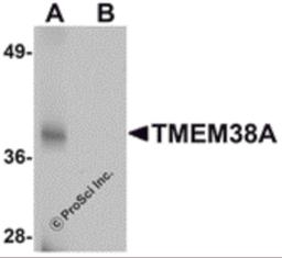 Western blot analysis of TMEM38A in rat skeletal muscle tissue lysate with TMEM38A antibody at 1 μg/mL in (A) the absence and (B) the presence of blocking peptide.