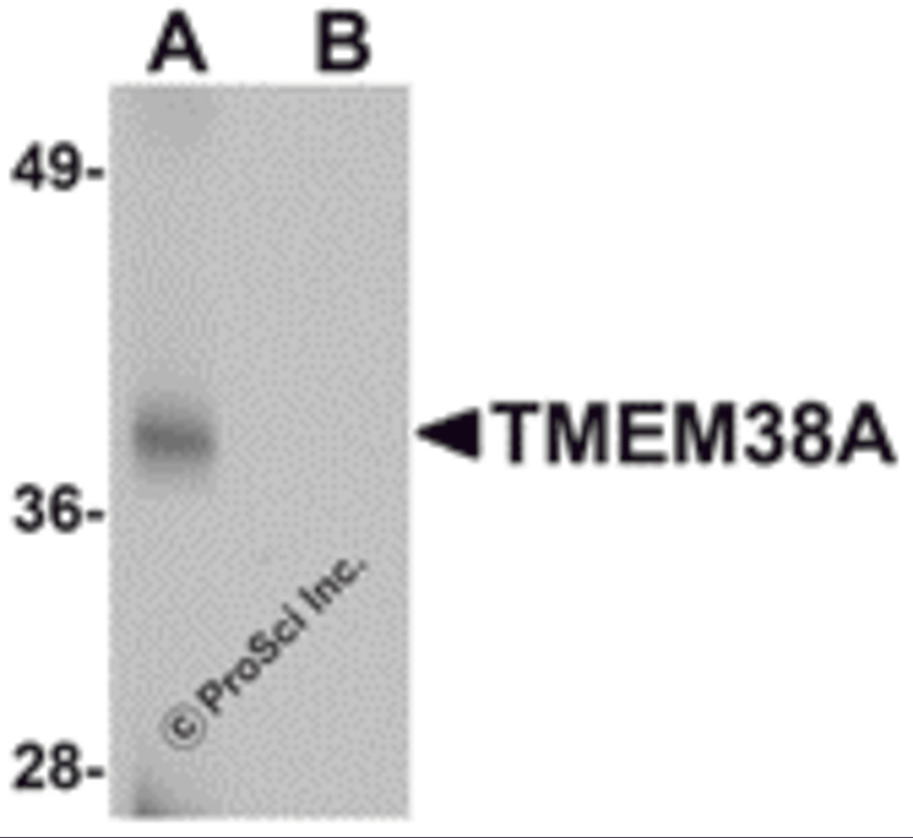 Western blot analysis of TMEM38A in rat skeletal muscle tissue lysate with TMEM38A antibody at 1 μg/mL in (A) the absence and (B) the presence of blocking peptide.