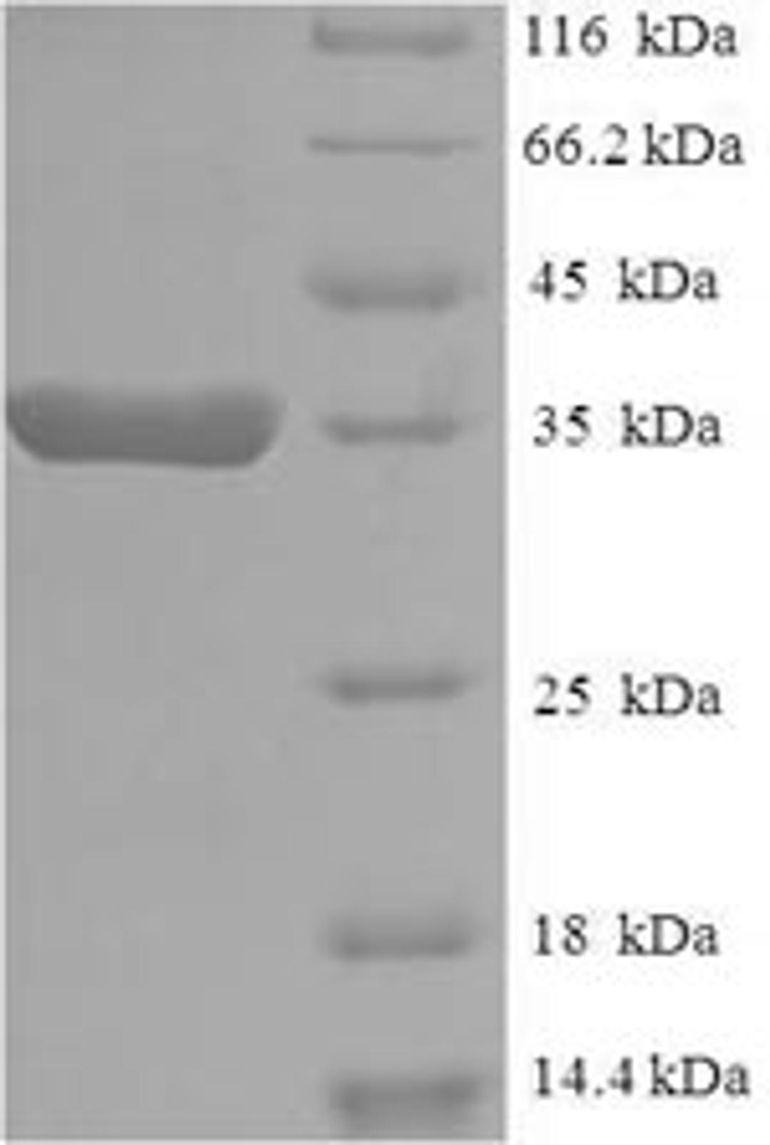 (Tris-Glycine gel) Discontinuous SDS-PAGE (reduced) with 5% enrichment gel and 15% separation gel.