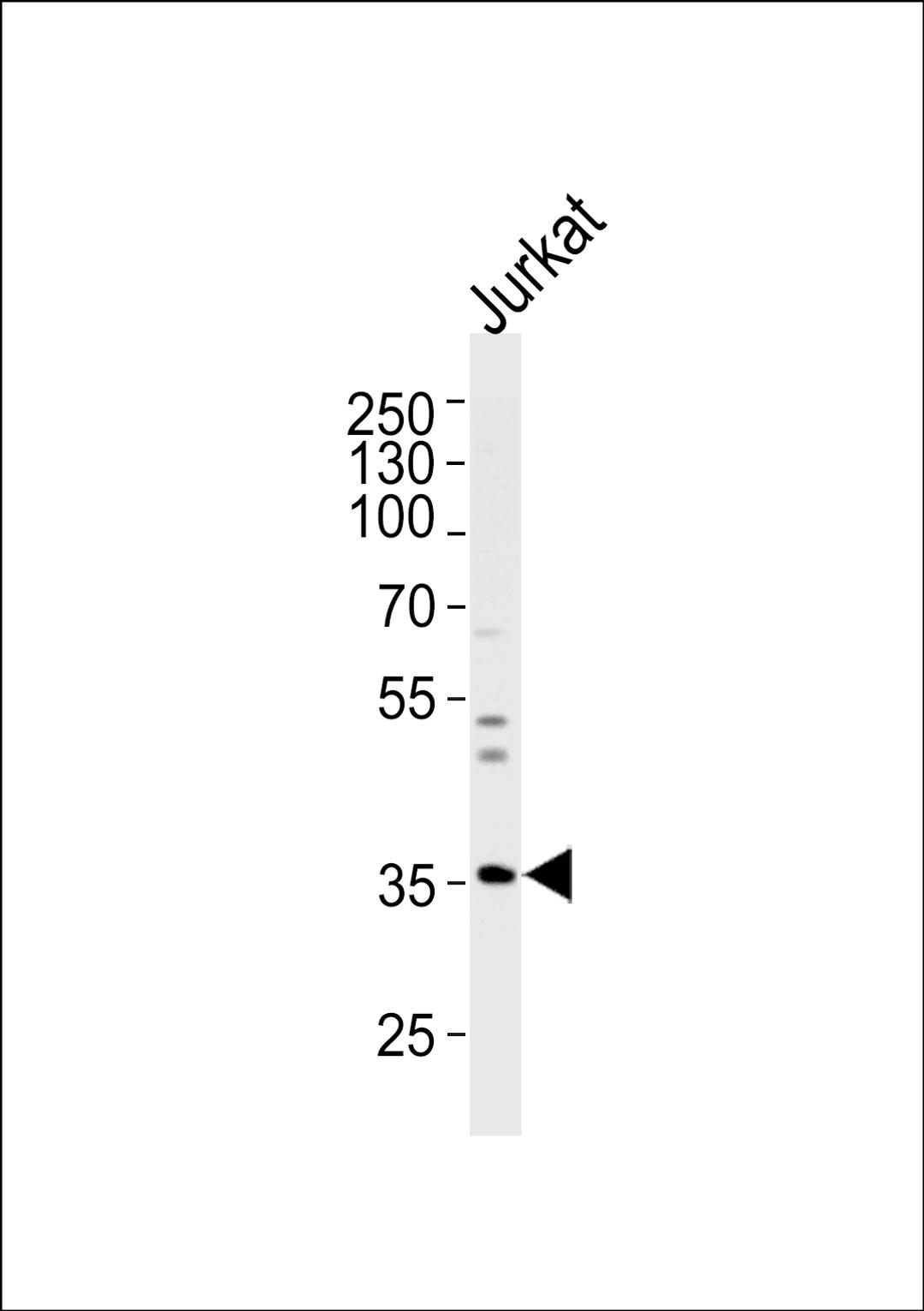 Western blot analysis of lysate from Jurkat cell line, using GLRB Antibody at 1:1000 at each lane.