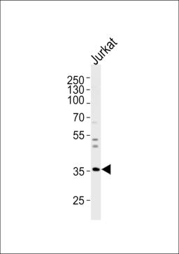 Western blot analysis of lysate from Jurkat cell line, using GLRB Antibody at 1:1000 at each lane.