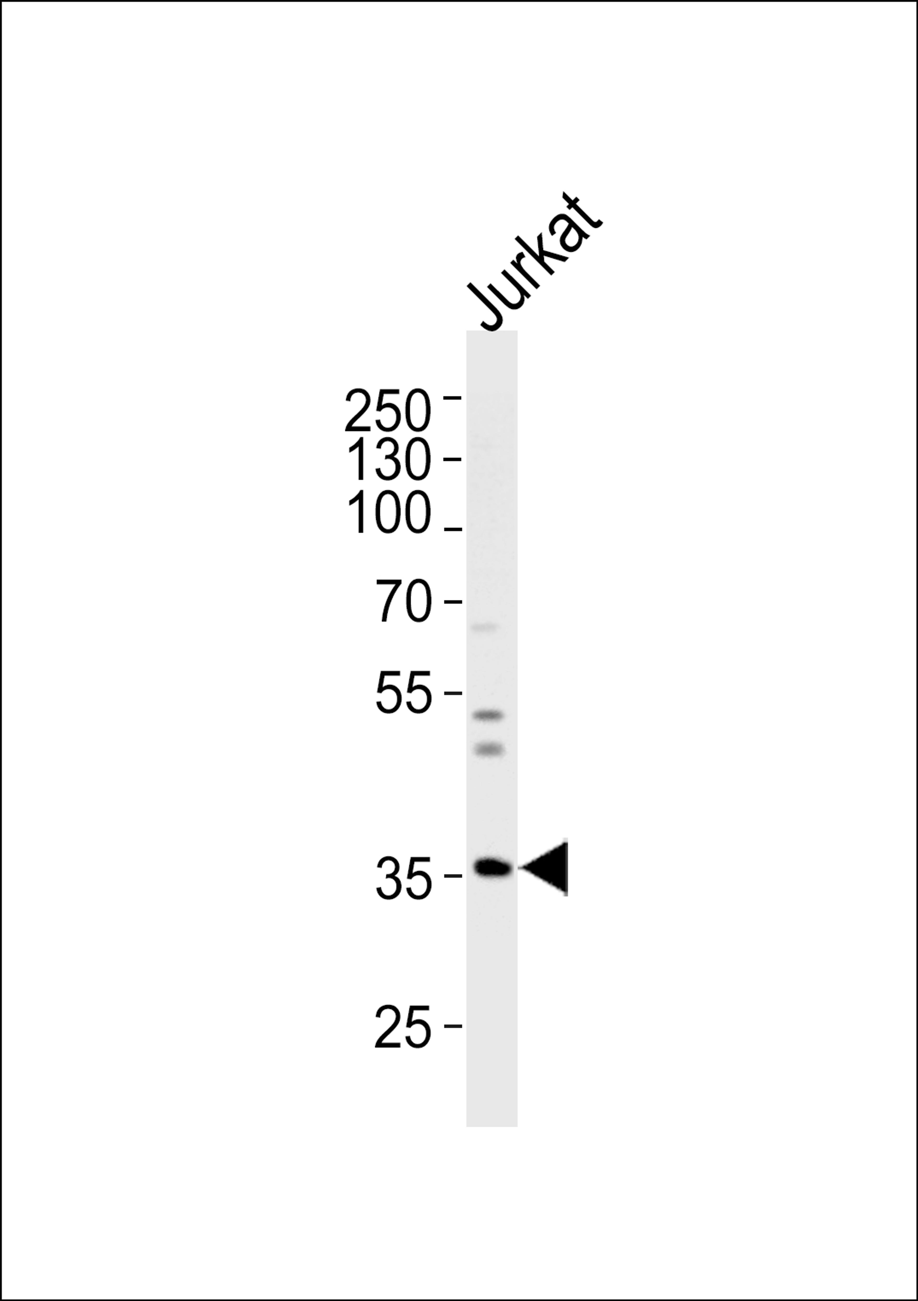 Western blot analysis of lysate from Jurkat cell line, using GLRB Antibody at 1:1000 at each lane.