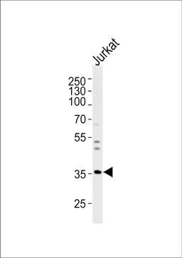 Western blot analysis of lysate from Jurkat cell line, using GLRB Antibody at 1:1000 at each lane.