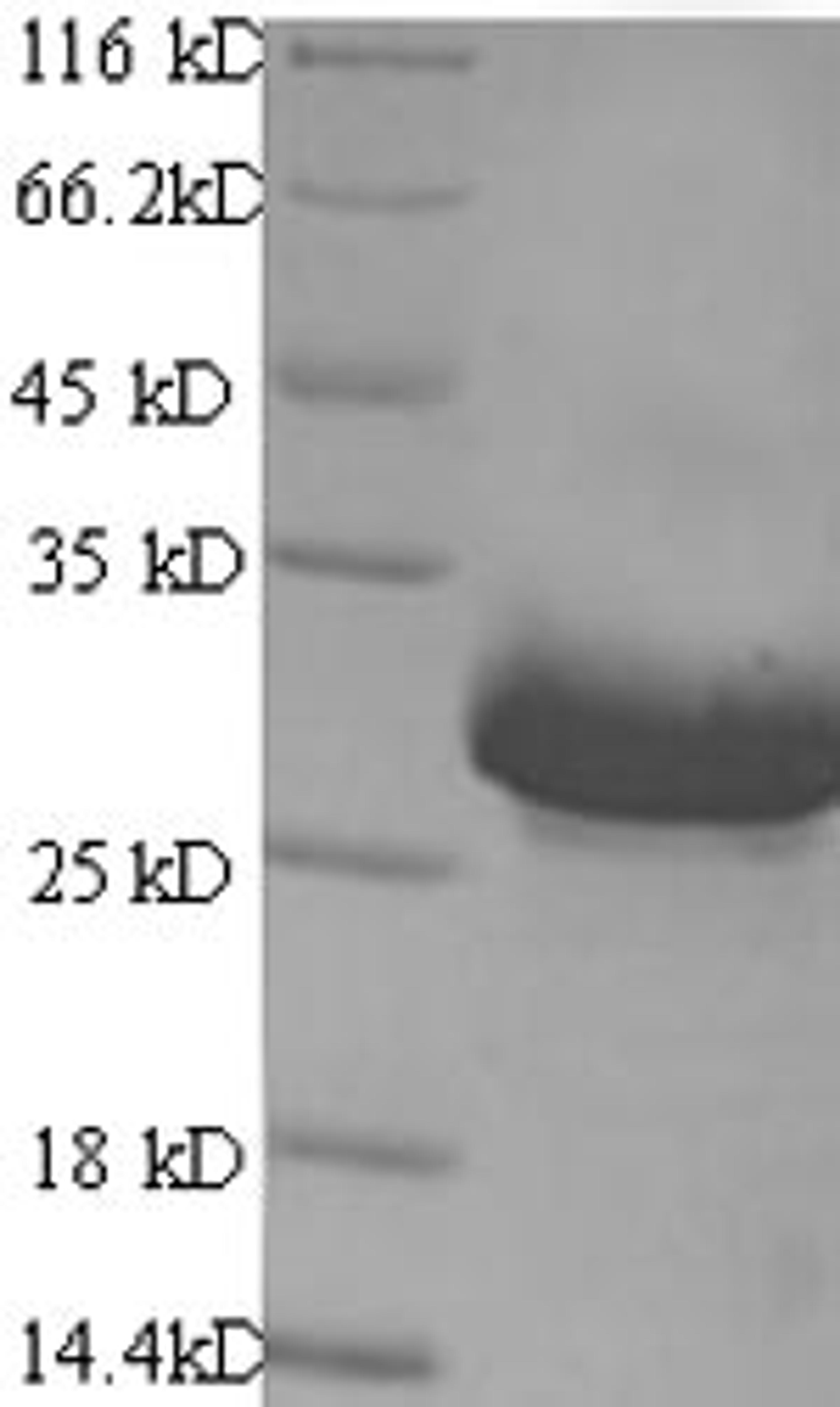 (Tris-Glycine gel) Discontinuous SDS-PAGE (reduced) with 5% enrichment gel and 15% separation gel.