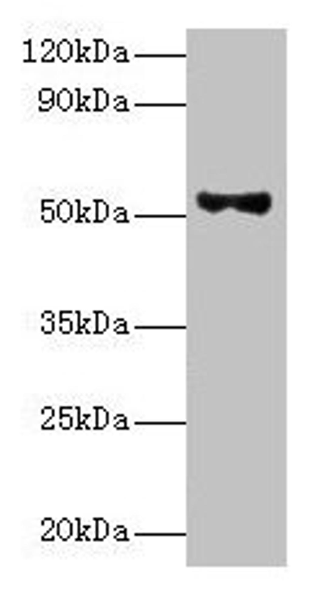 Western blot. All lanes: Patatin-like phospholipase domain-containing protein 3 antibody at 8ug/ml + HepG2 whole cell lysate. Secondary. Goat polyclonal to rabbit IgG at 1/10000 dilution. Predicted band size: 53 kDa. Observed band size: 53 kDa.