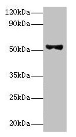 Western blot. All lanes: Patatin-like phospholipase domain-containing protein 3 antibody at 8ug/ml + HepG2 whole cell lysate. Secondary. Goat polyclonal to rabbit IgG at 1/10000 dilution. Predicted band size: 53 kDa. Observed band size: 53 kDa.