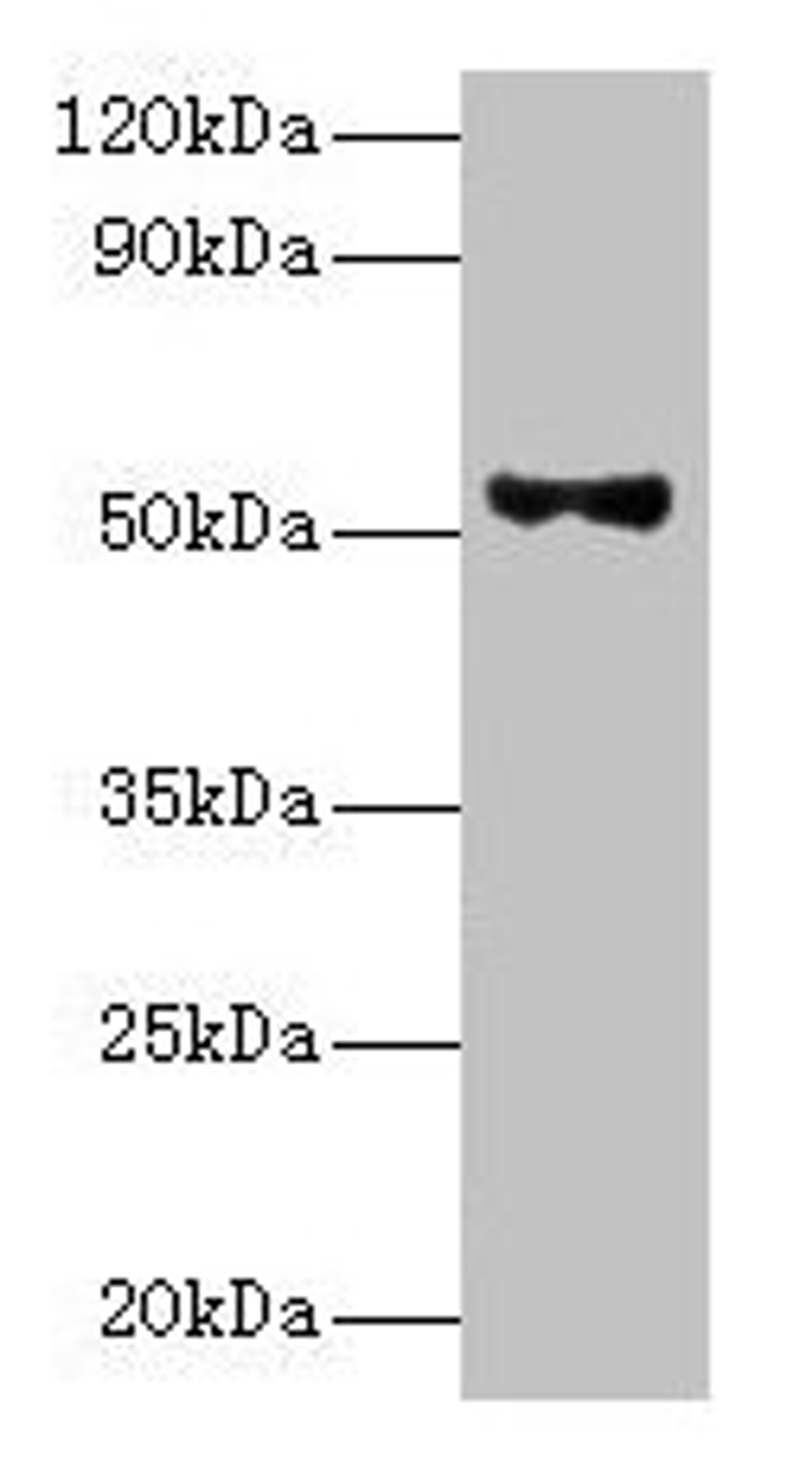 Western blot. All lanes: Patatin-like phospholipase domain-containing protein 3 antibody at 8ug/ml + HepG2 whole cell lysate. Secondary. Goat polyclonal to rabbit IgG at 1/10000 dilution. Predicted band size: 53 kDa. Observed band size: 53 kDa.