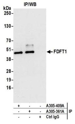 Detection of human FDFT1 by western blot of immunoprecipitates.