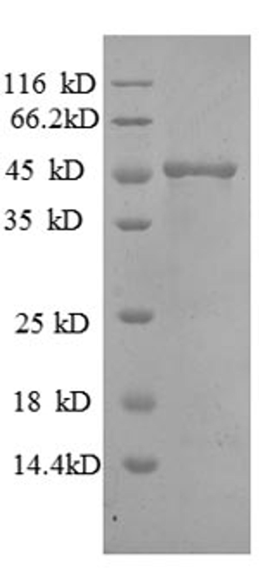 (Tris-Glycine gel) Discontinuous SDS-PAGE (reduced) with 5% enrichment gel and 15% separation gel.
