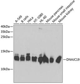 Western blot - DNAJC19 antibody (A5146)