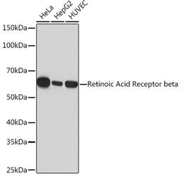 Western blot - Retinoic Acid Receptor beta Rabbit mAb (A4535)