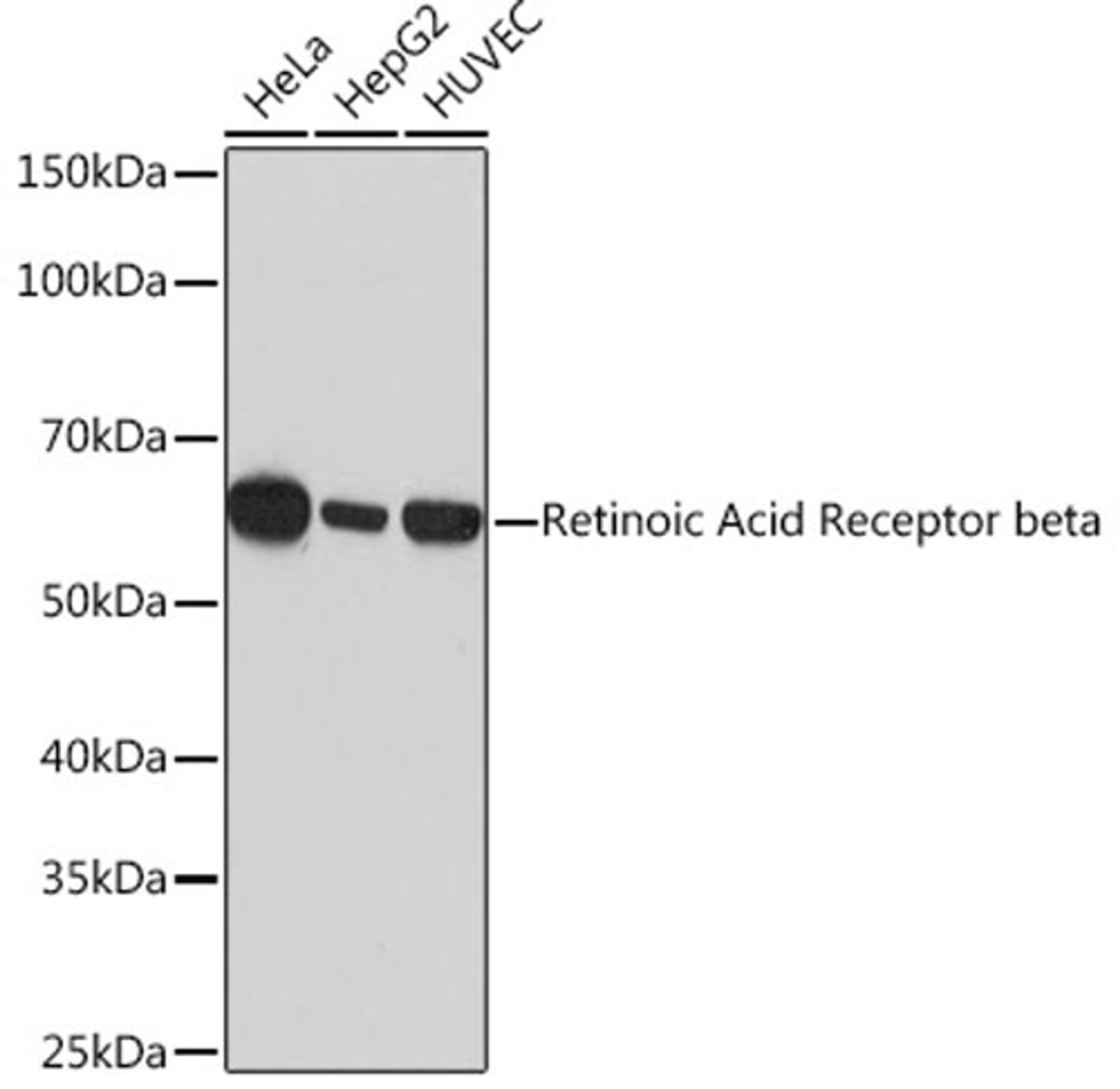 Western blot - Retinoic Acid Receptor beta Rabbit mAb (A4535)