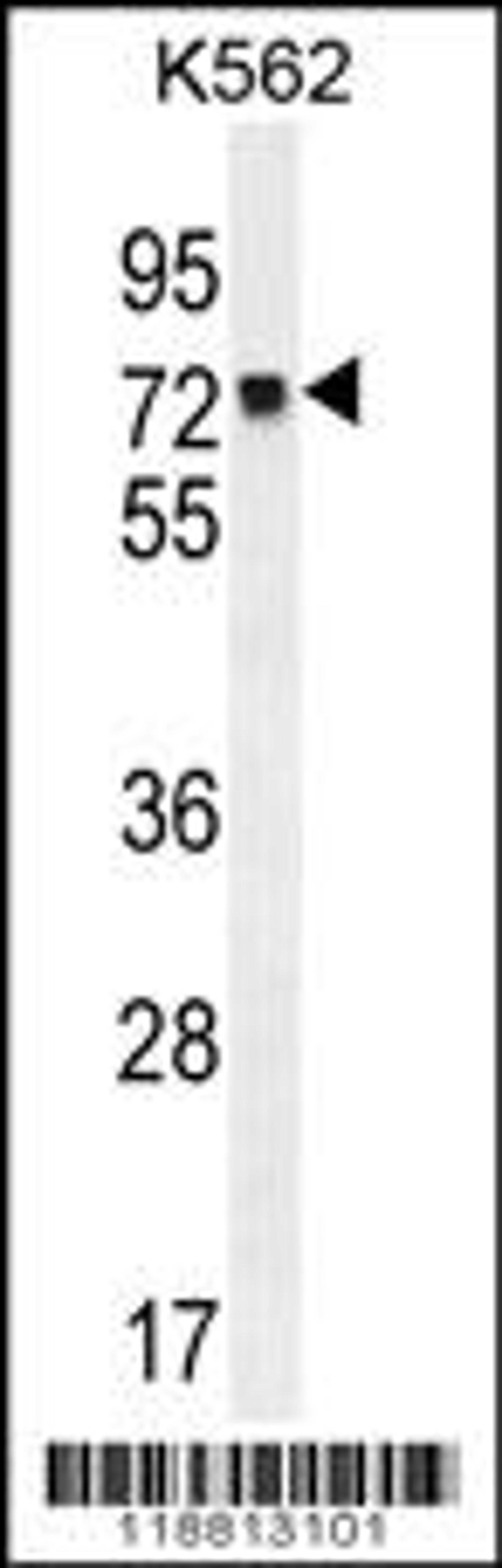 Western blot analysis in K562 cell line lysates (35ug/lane).