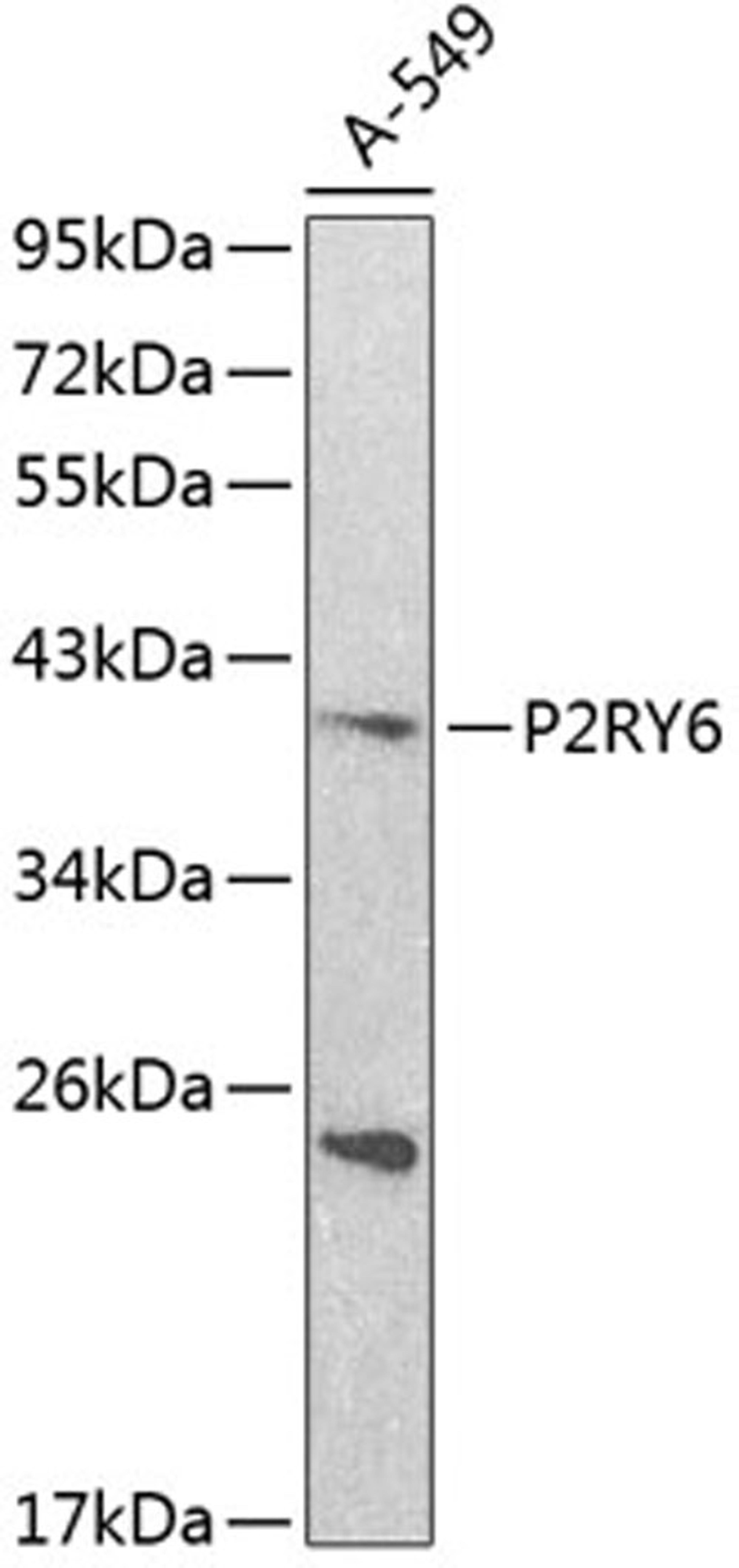 Western blot - P2RY6 antibody (A2485)