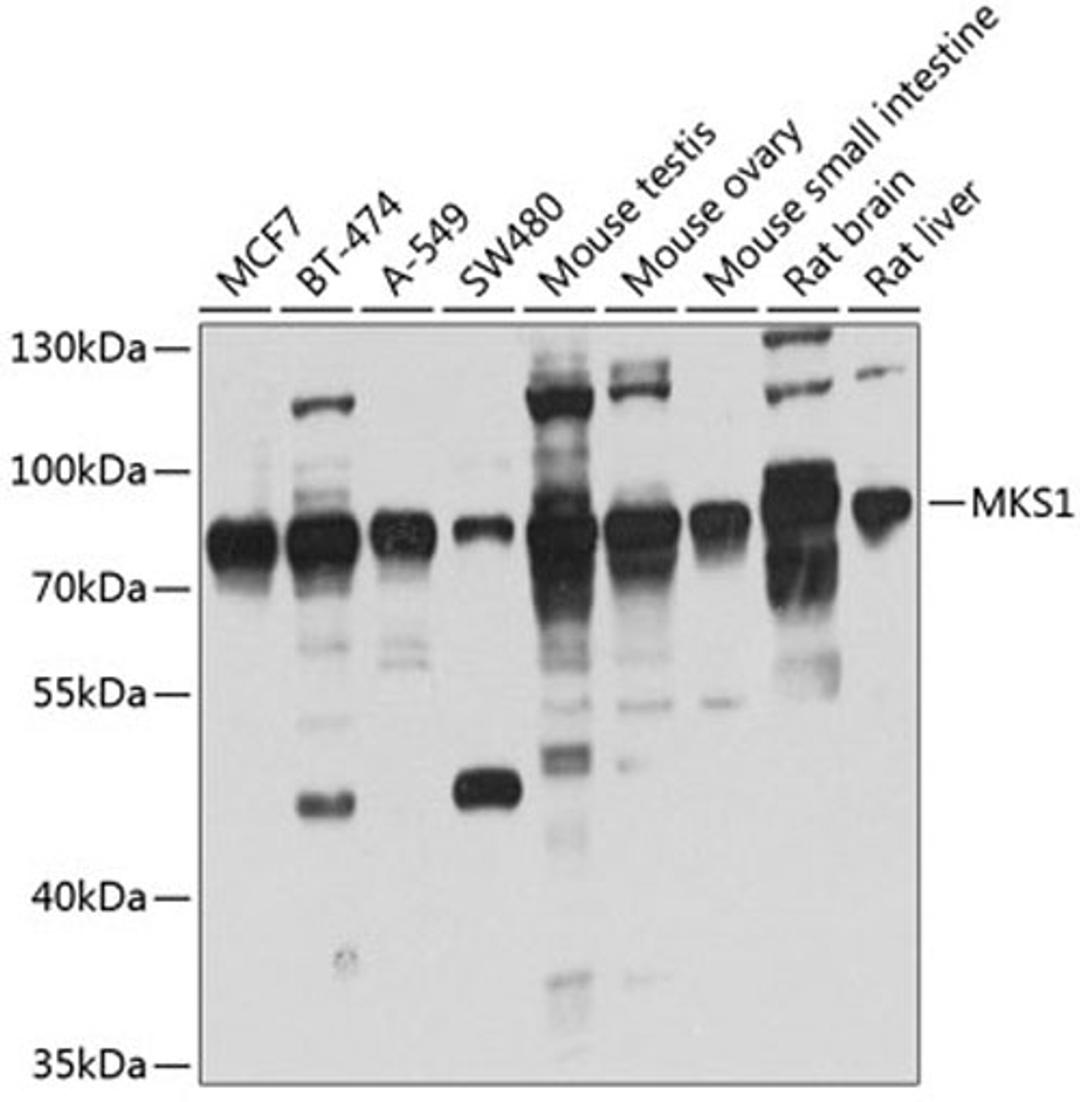 Western blot - MKS1 antibody (A4802)