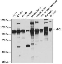 Western blot - MKS1 antibody (A4802)