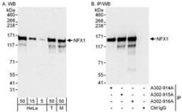 Detection of human and mouse NFX1 by western blot (h&m) and immunoprecipitation (h).