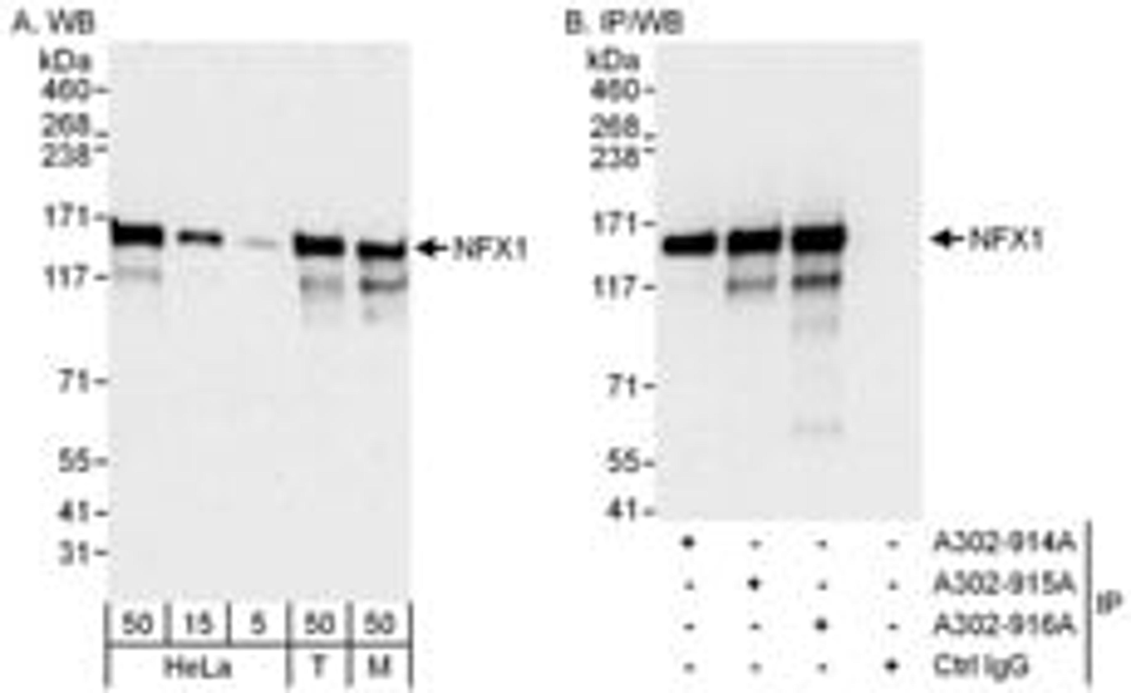 Detection of human and mouse NFX1 by western blot (h&m) and immunoprecipitation (h).