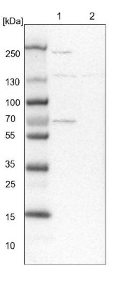 Western Blot: Xylulokinase/XYLB Antibody [NBP1-87919] - Lane 1: NIH-3T3 cell lysate (Mouse embryonic fibroblast cells)<br/>Lane 2: NBT-II cell lysate (Rat Wistar bladder tumour cells)