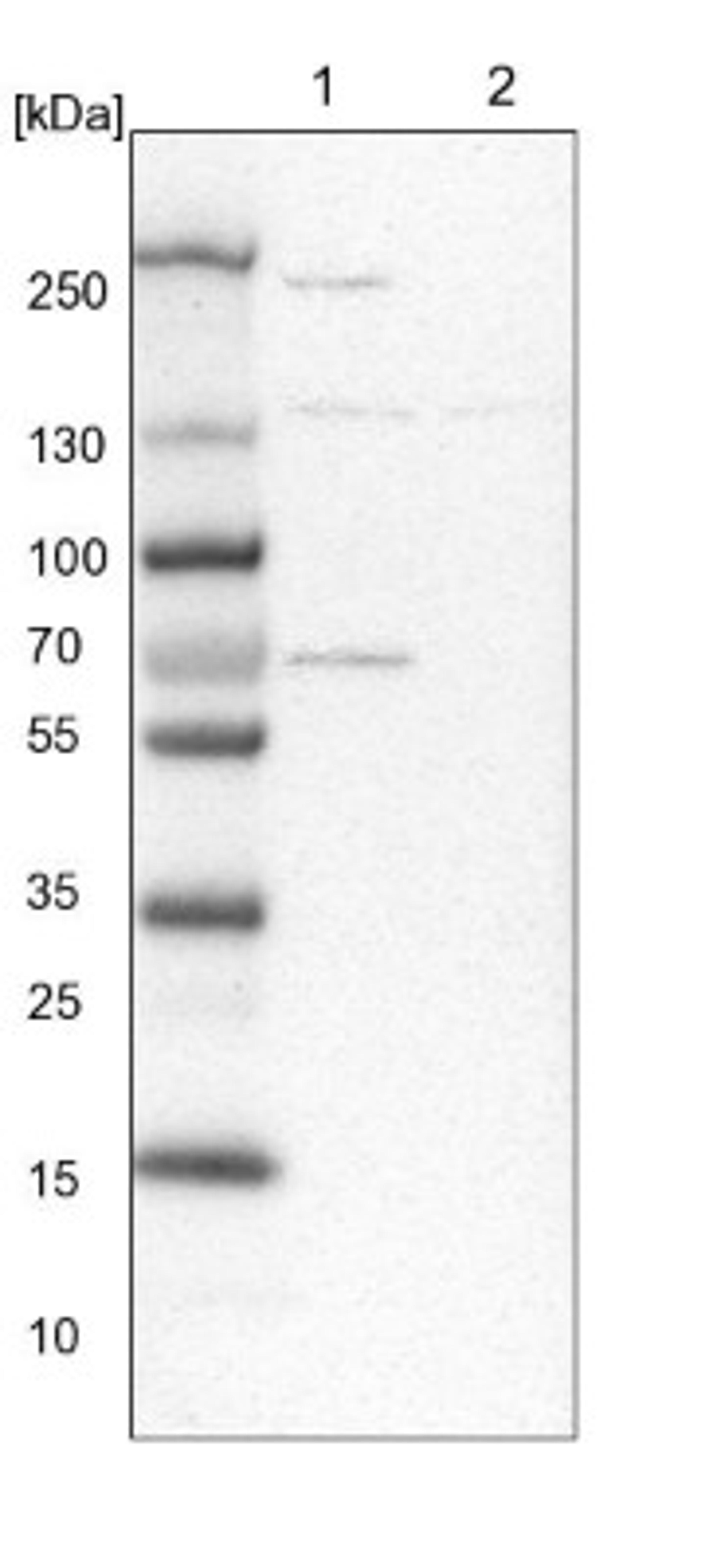 Western Blot: Xylulokinase/XYLB Antibody [NBP1-87919] - Lane 1: NIH-3T3 cell lysate (Mouse embryonic fibroblast cells)<br/>Lane 2: NBT-II cell lysate (Rat Wistar bladder tumour cells)